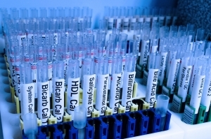 test, tube, lab-218181.jpg