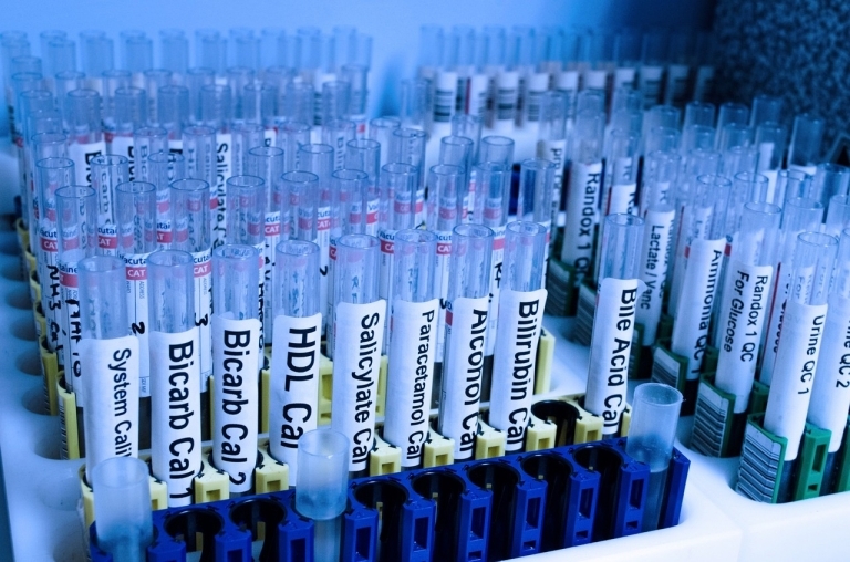 test, tube, lab-218181.jpg